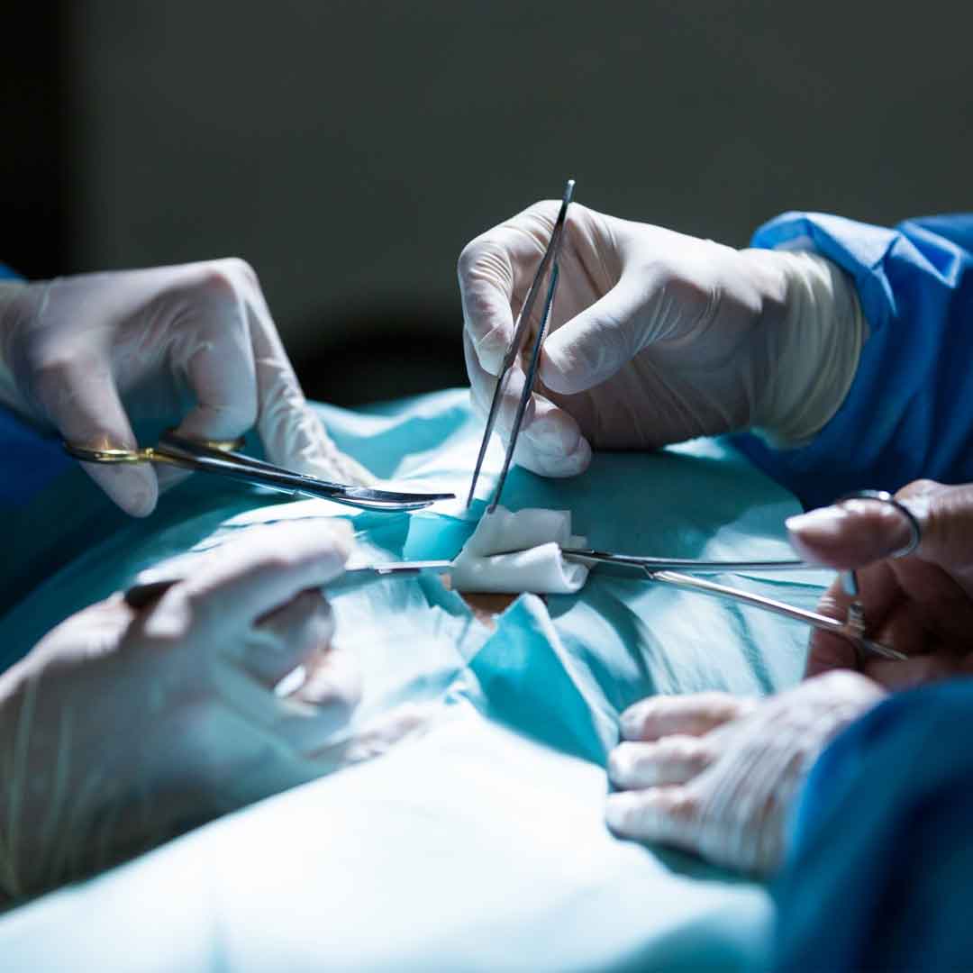 Laparoscopic Surgery